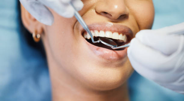 Best Chipped Tooth Repair Near Me  in South Whitley, IN