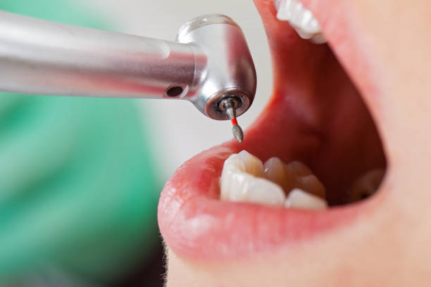 Best Root Canal Emergency Dentist  in South Whitley, IN